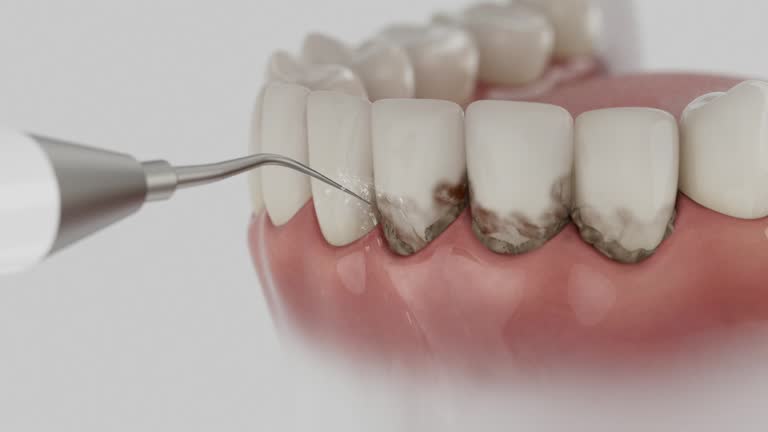 Reliable Emergency Dentist contractor in Silsbee, TX by Smile Center Dentistry